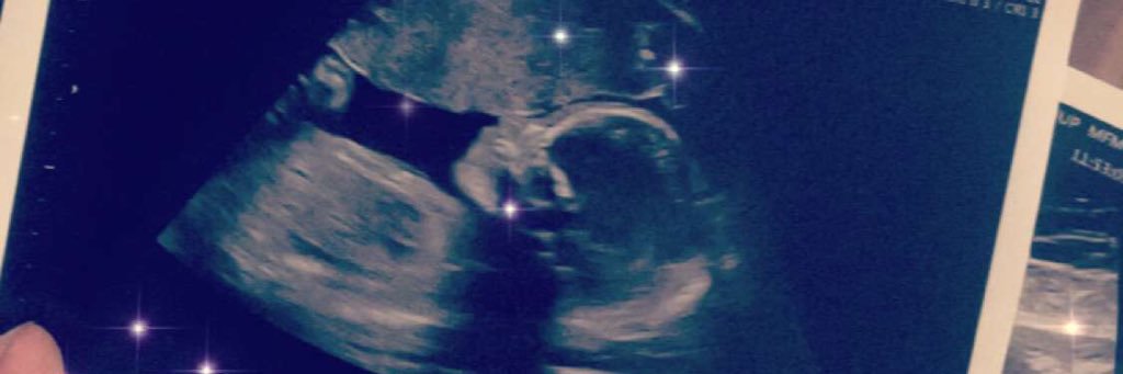 __MZMH's profile banner image