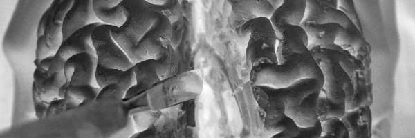 leuthardt Profile Banner