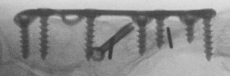 BTH Foot & Ankle banner