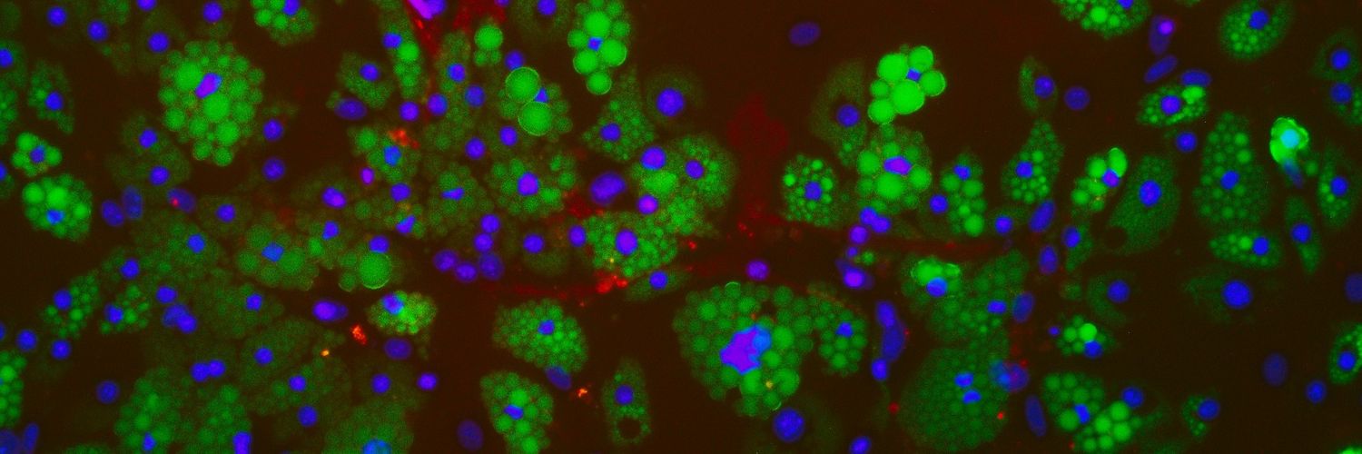 Alice Pollard banner