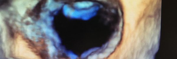 valvulopatiaSEC Profile Banner