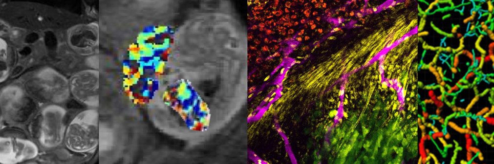 michal neeman banner