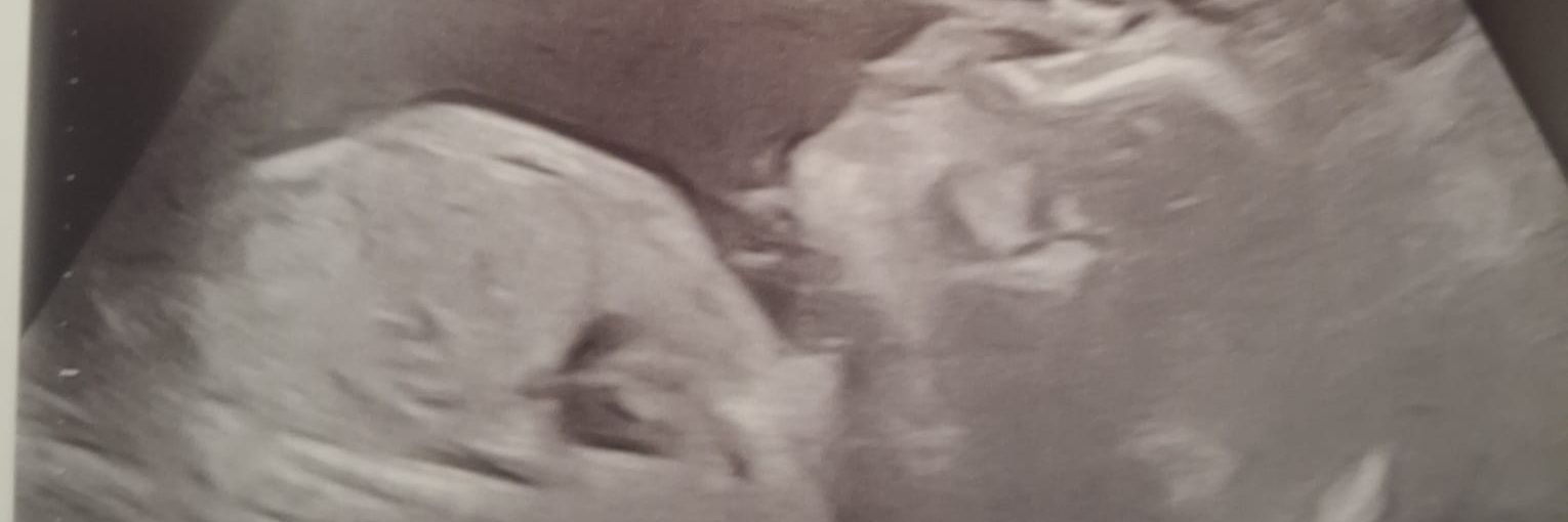 Eli Elkin-Bradeley banner