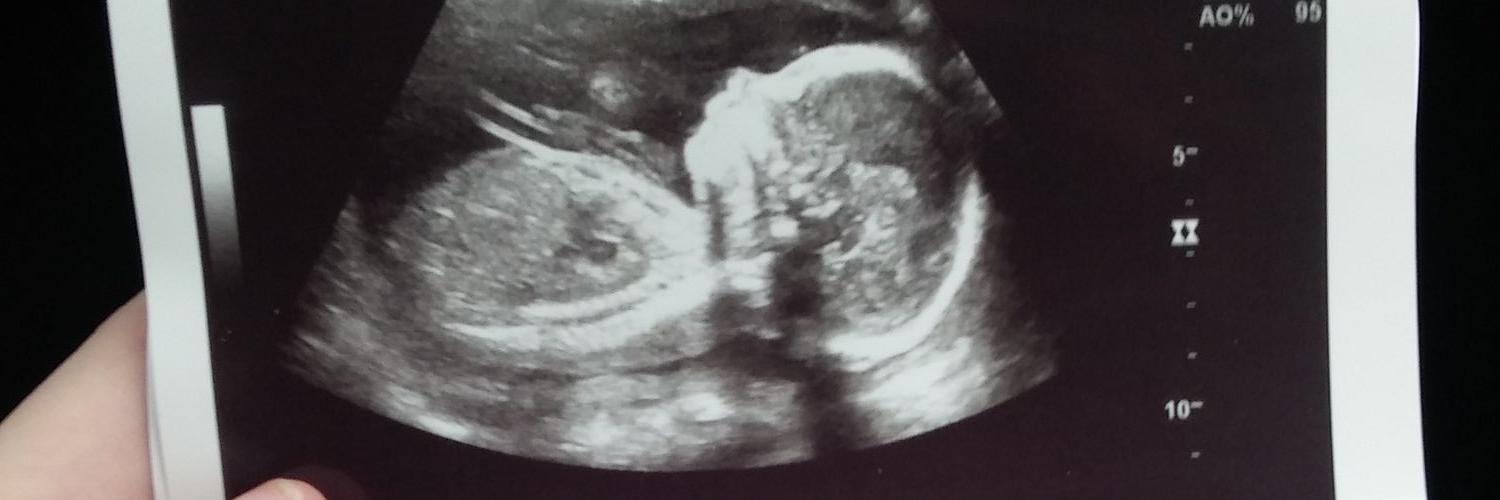 remily12's profile banner image
