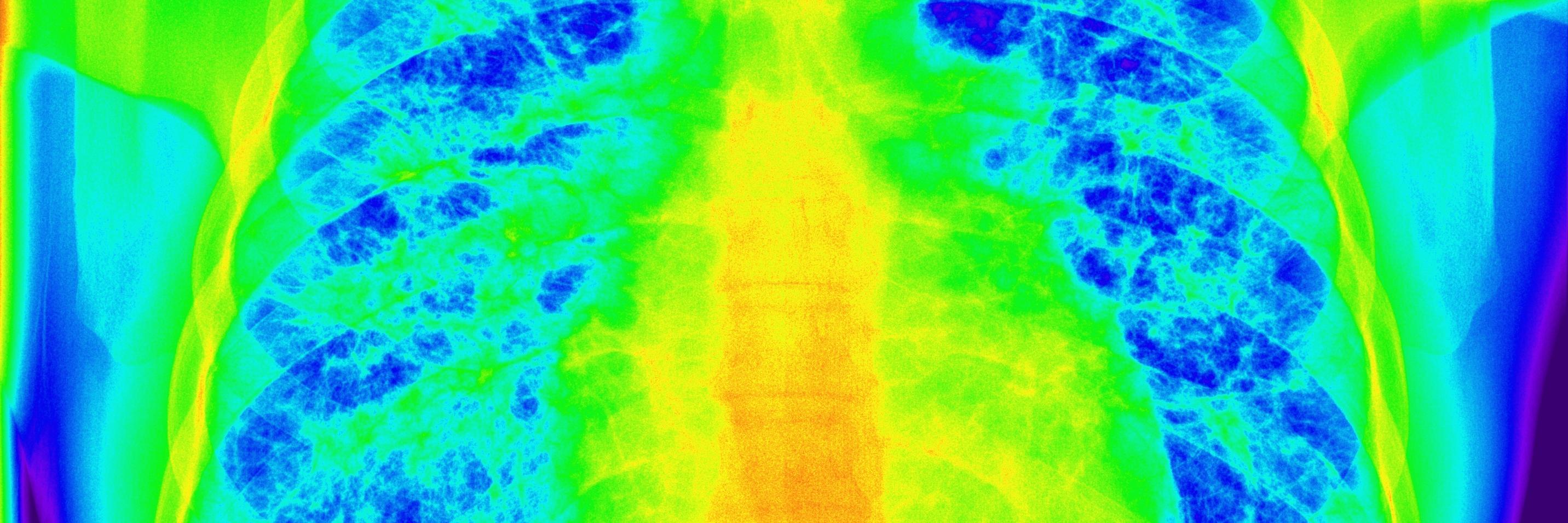 Rayza Elizabeth banner