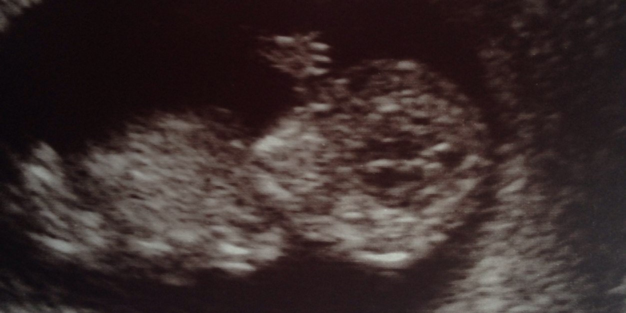 Myranda ❤️ banner