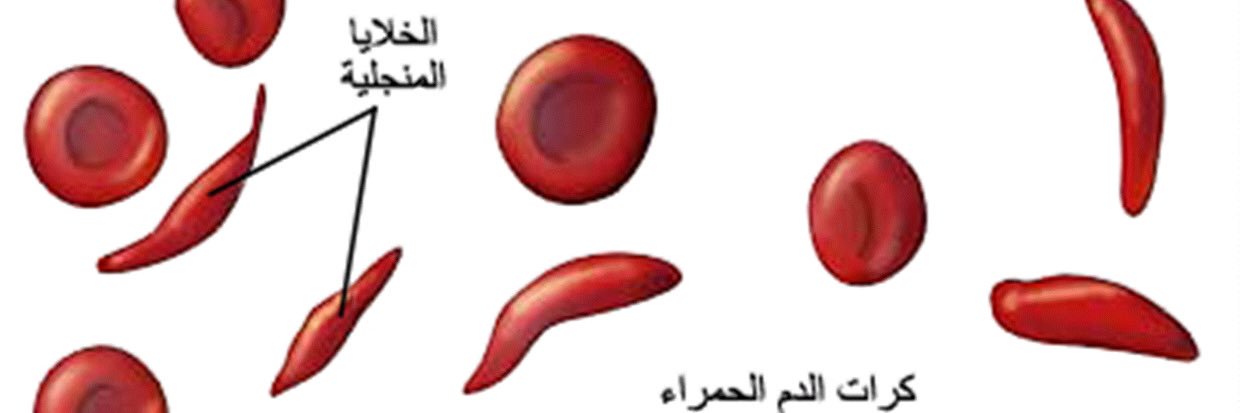الأنيميا المنجلية @ banner
