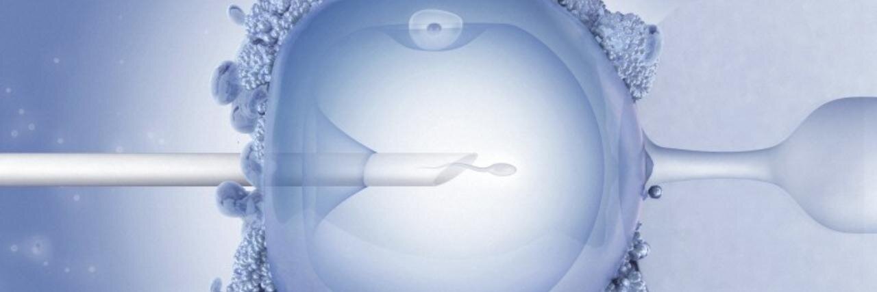 Burak Ozkosem, PhD banner