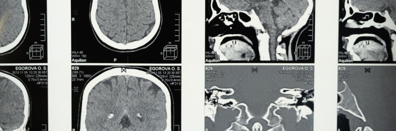 NeurosurgeryBot banner