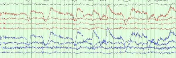 epilepsy_liv Profile Banner