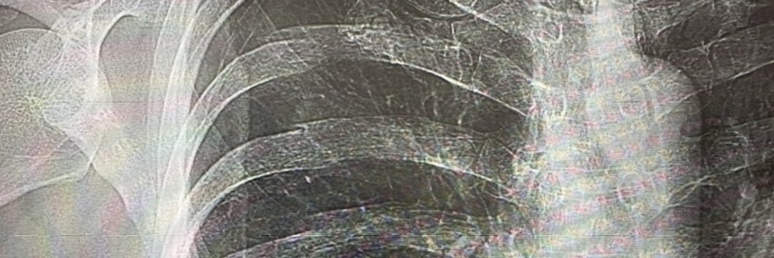 ‾‾ʞzɯ banner