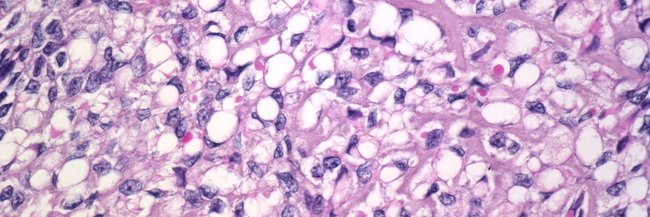 Chris Felicelli banner