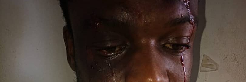 Zim Brief On Rights Abuses banner