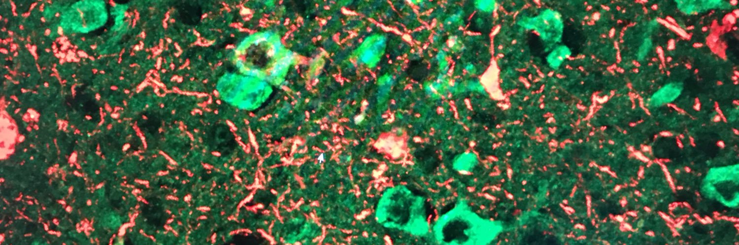 Adam Bachstetter banner