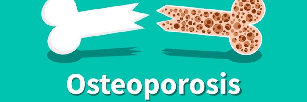 ESHT Fracture Liaison Service banner