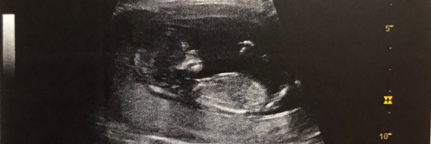 MegsH64's profile banner image