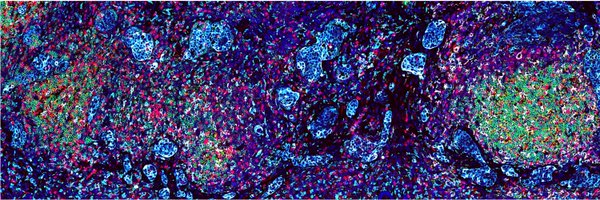 SystemTumor Profile Banner