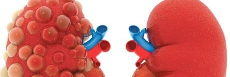 زراعة الكلي والكبد بالخارج وتوفير المتبرع banner