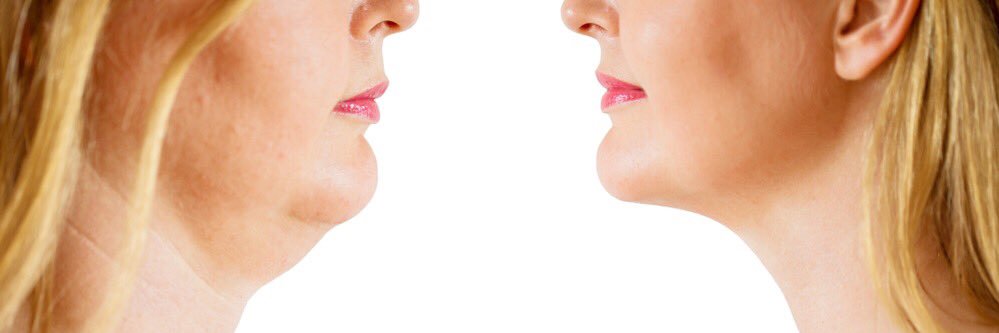 FashionBody2's profile banner image