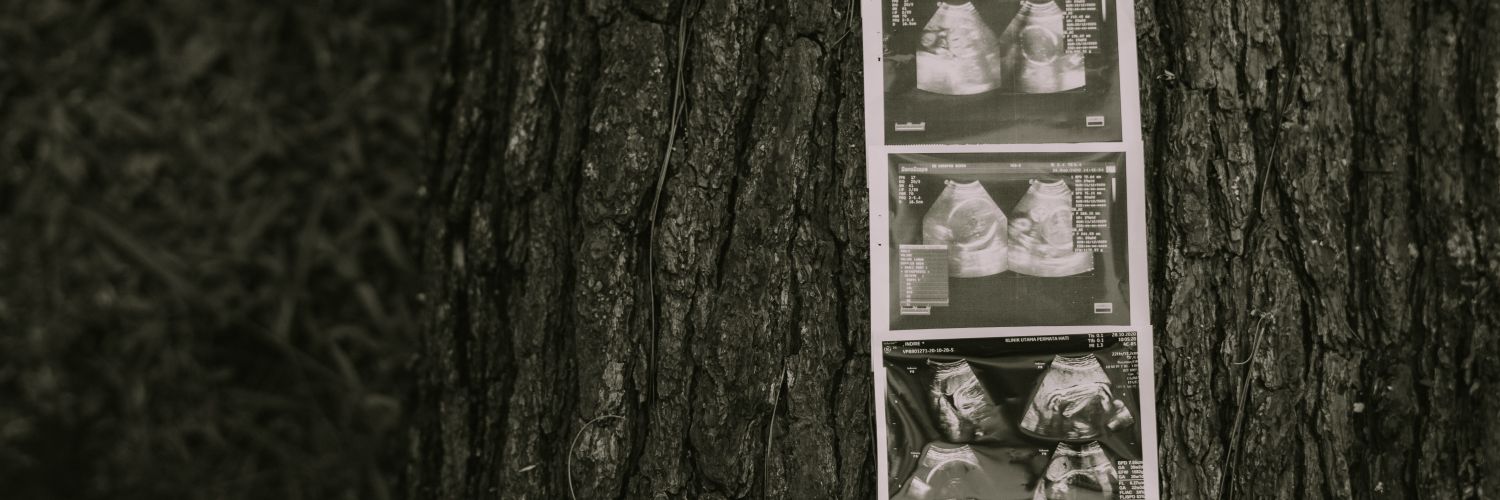qazaleaaa's profile banner image