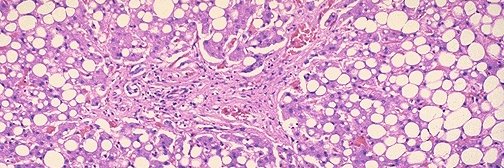 ILTS Basic and Translational Research Committee banner