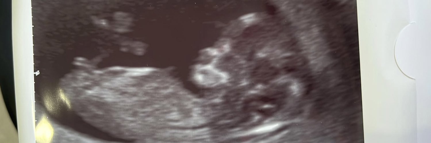 XSeonaid's profile banner image