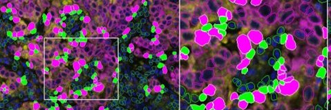 Erin Schenk, MD, PhD banner