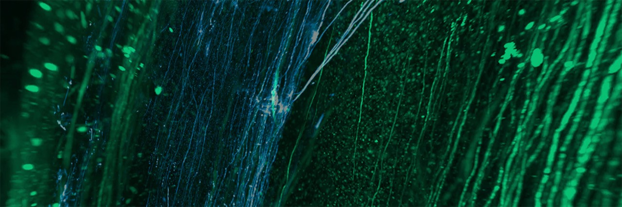 Translucence Biosystems banner