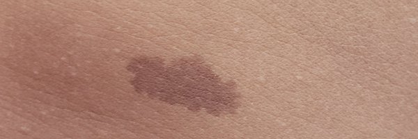 BrwnSkinMatters Profile Banner