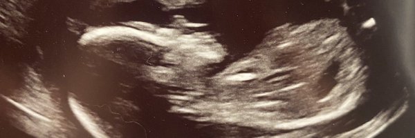 kriswalker22 Profile Banner