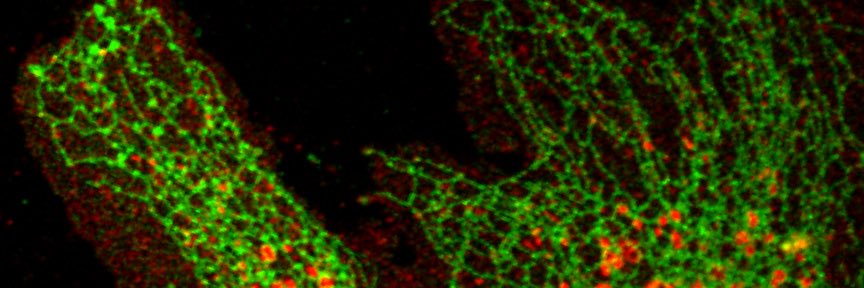 Alison Forrester banner