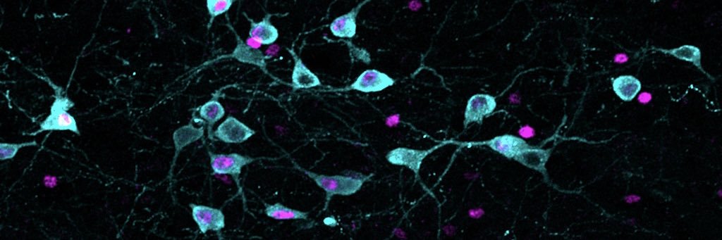 Kade Huckstep banner