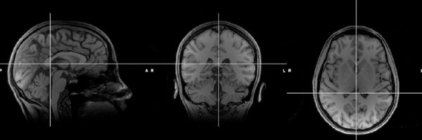 LuluBigbrain Profile Banner