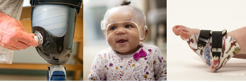 Union Orthotics & Prosthetics Co. banner