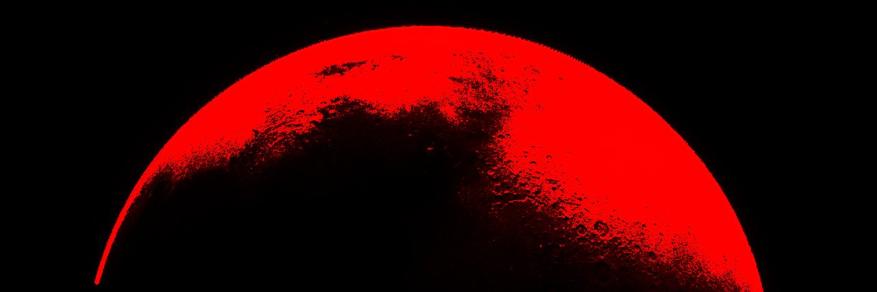 αντίθεση's banner