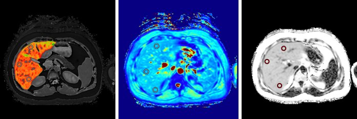 LiverMultiScan banner