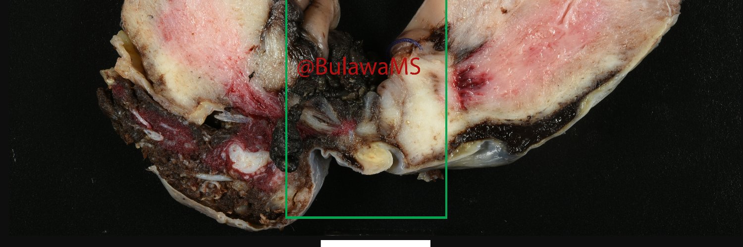 Lainee Bulawa, MS, PA (ASCP) banner