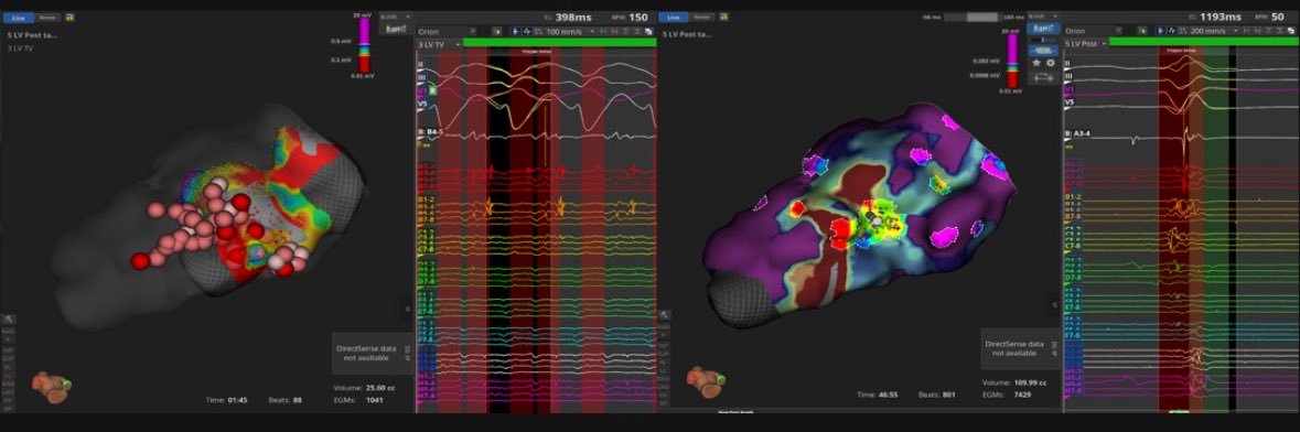 Olga Durán Bobin banner