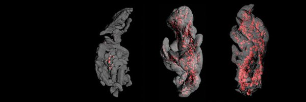 lighttodiabetes Profile Banner