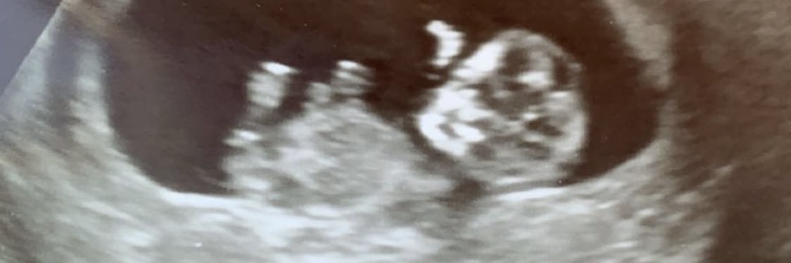 _RoryAtkins_'s profile banner image