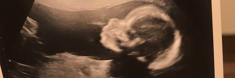 EmzlouOx's profile banner image