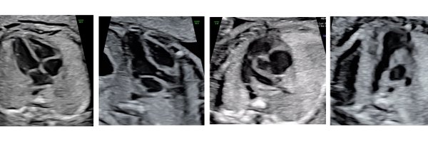 FetalHeartSoc Profile Banner