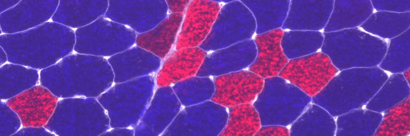 Freek Van de Casteele banner