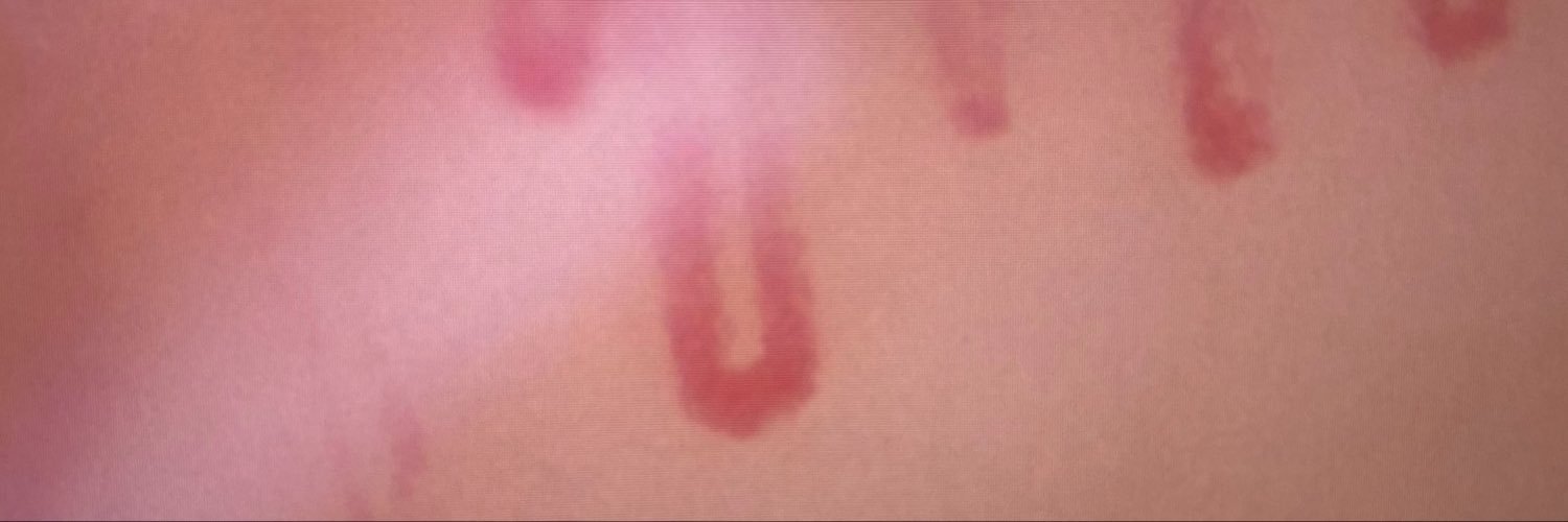 ReumaPOCUS's profile banner image