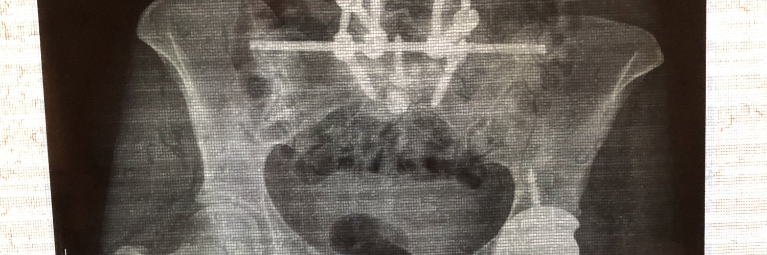 P. ⭐️⭐️♿️(she/her) banner