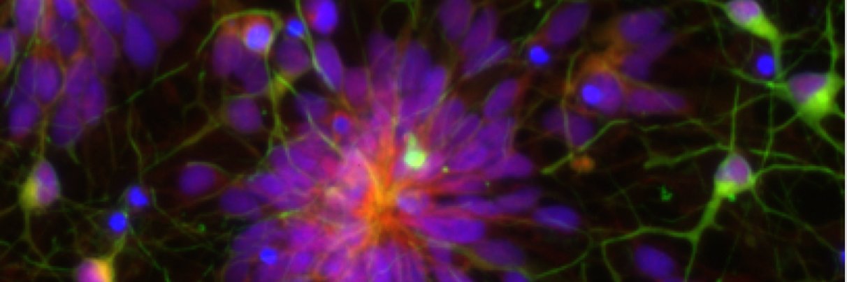 NeuroImmunePhD's banner