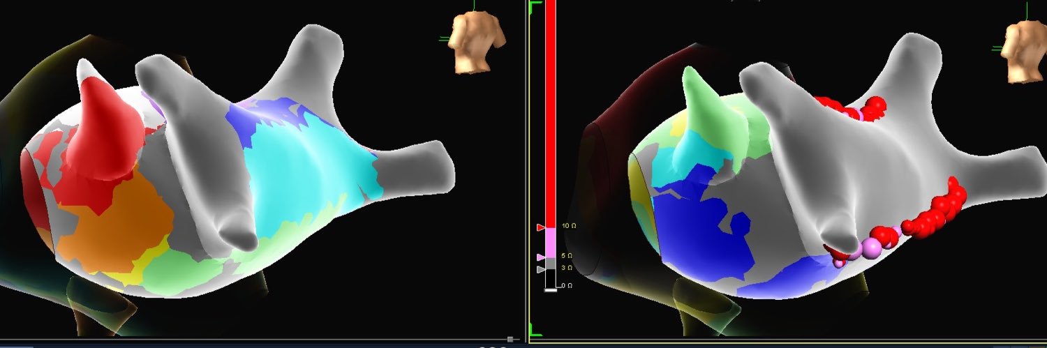 Paige Reisman - EP banner