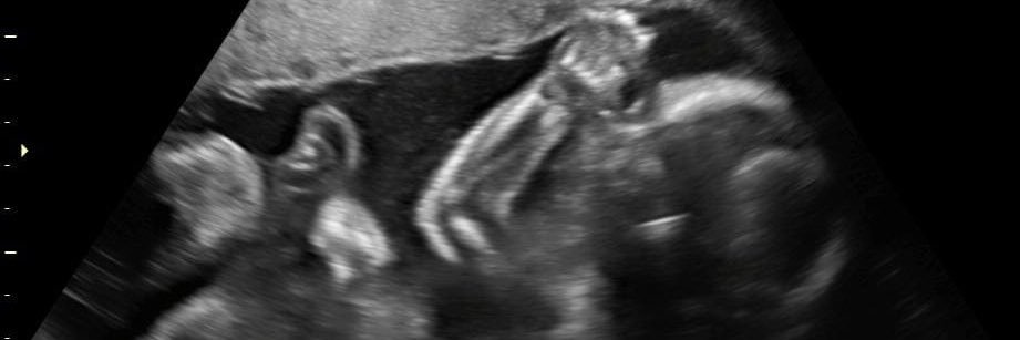 BrenGomez144's profile banner image