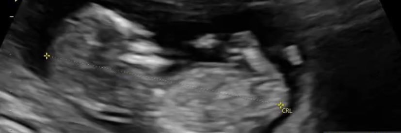 laramilenaa_'s profile banner image