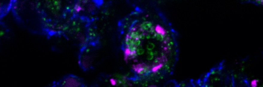 Raghu Chivukula, MD PhD 🫁🧬🧠's banner